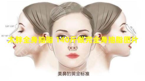 太胖全身抽脂 140斤做完全身抽脂图片